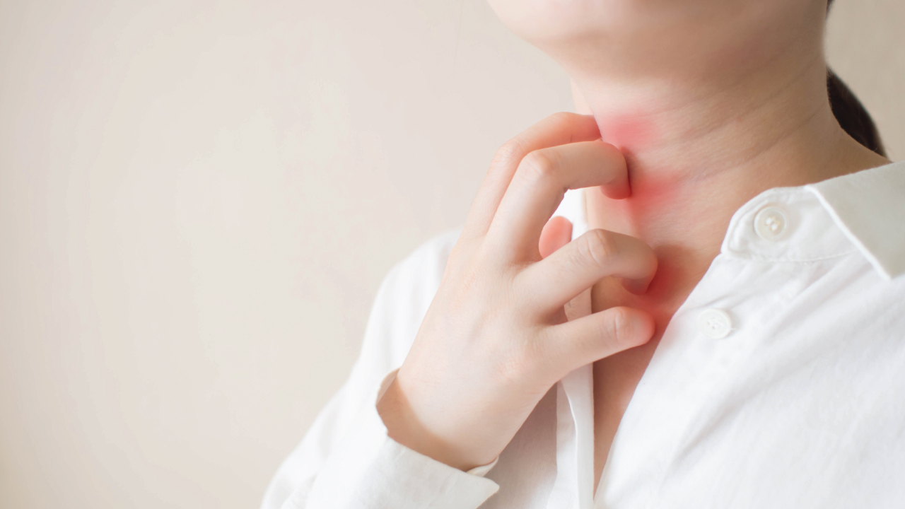 Alergia à carne suína, isso realmente existe?